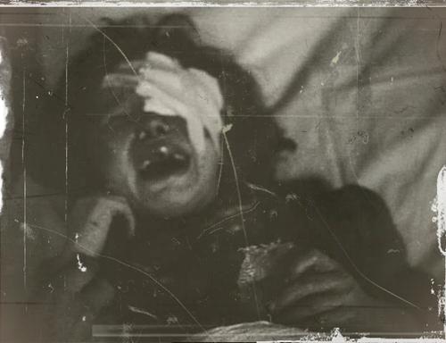 enfant blessé pendant l'exode de 1940