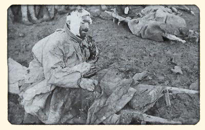 blesse pendant la bataille de Verdun